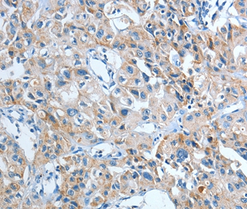 IL21R Antibody