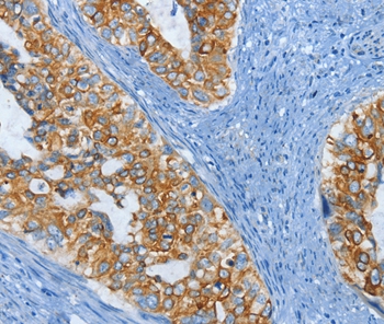 KRT81 Antibody