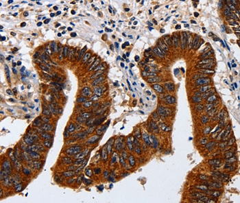 KRT23 Antibody