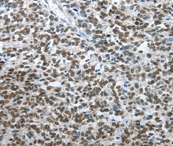ARL2 Antibody