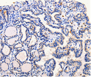 ARL6 Antibody