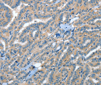 RAP1A Antibody
