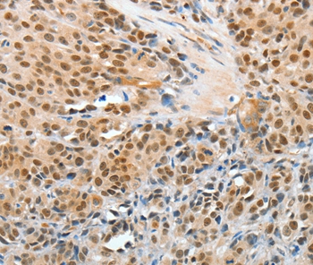 APPL1 Antibody