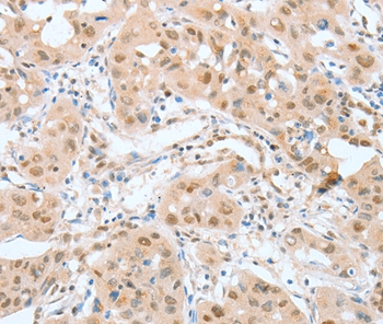 ATF2 Antibody