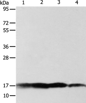 ATP5J Antibody
