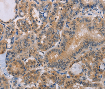 BTG1 Antibody