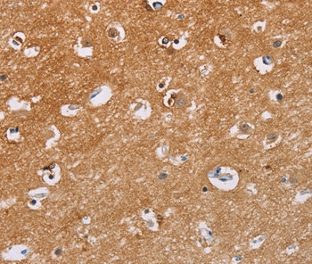 CAPN7 Antibody