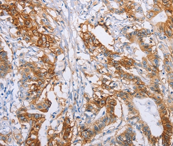 CA9 Antibody