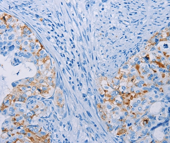 CA10 Antibody
