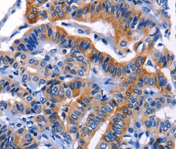 CHI3L1 Antibody