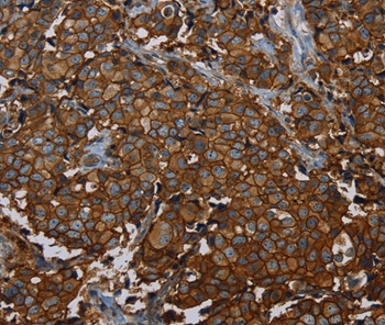 ERBB4 Antibody