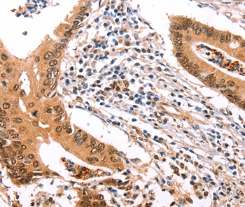 ERBB3 Antibody