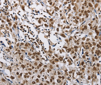 CMTM2 Antibody