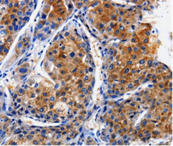 CLCA4 Antibody