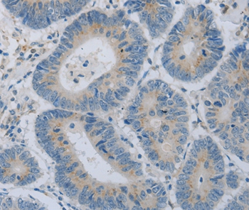 COL2A1 Antibody