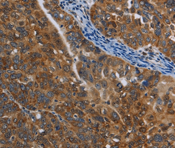 COX6B2 Antibody