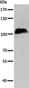 CTBP2 Antibody