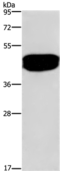 SDCCAG3 Antibody