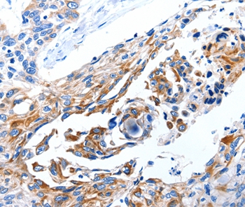 DAP Antibody