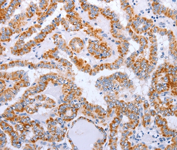DTX2 Antibody