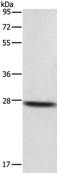 DKK2 Antibody