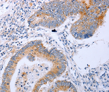 DNMT3L Antibody