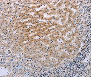 TNFRSF25  Antibody