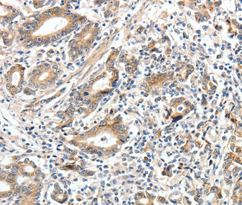 ECE2 Antibody