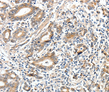 ECE2 Antibody