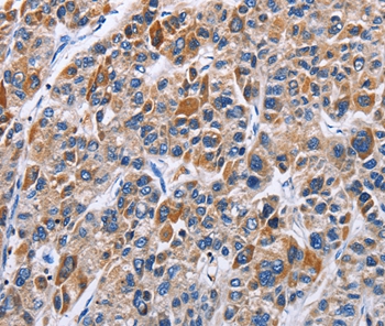 ENPP5 Antibody