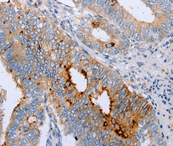 ENPP6 Antibody