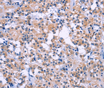 DUSP22 Antibody