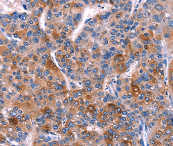 DUSP13 Antibody