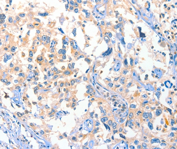 DUSP14 Antibody