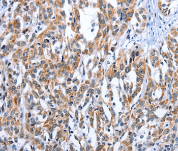 EDN3 Antibody