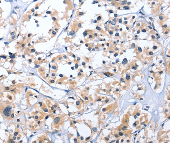 EDN3 Antibody