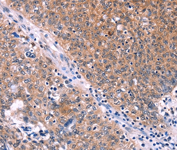 EDN1 Antibody