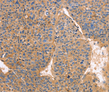 GNB1 Antibody