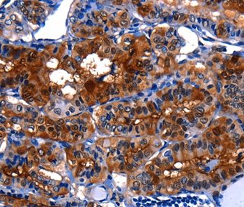 LGALS3 Antibody