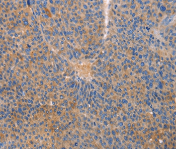 CXCL3 Antibody