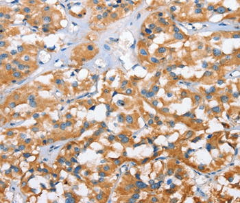 CXCL14 Antibody
