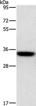 HOXB13 Antibody