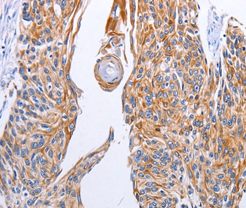 LIPE Antibody