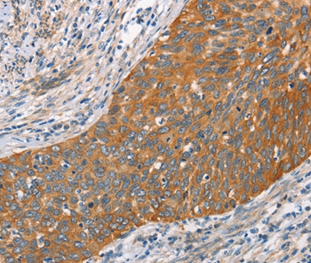 HSPB8 Antibody