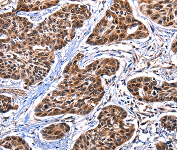 DFFA Antibody
