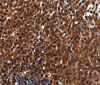 DFFA Antibody