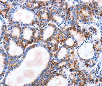 IGSF6 Antibody