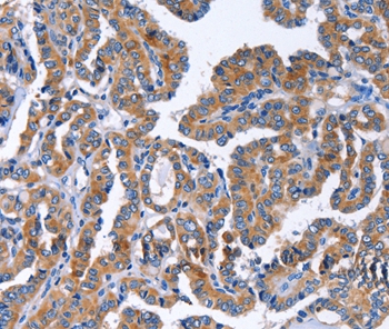 IGSF10 Antibody
