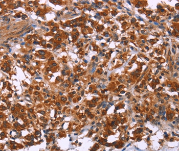 ING2 Antibody