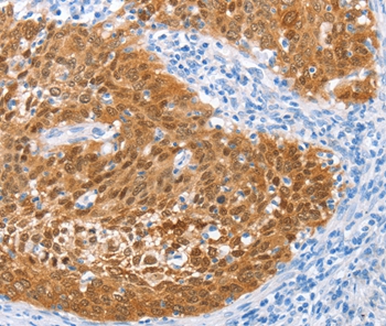 IRF6 Antibody